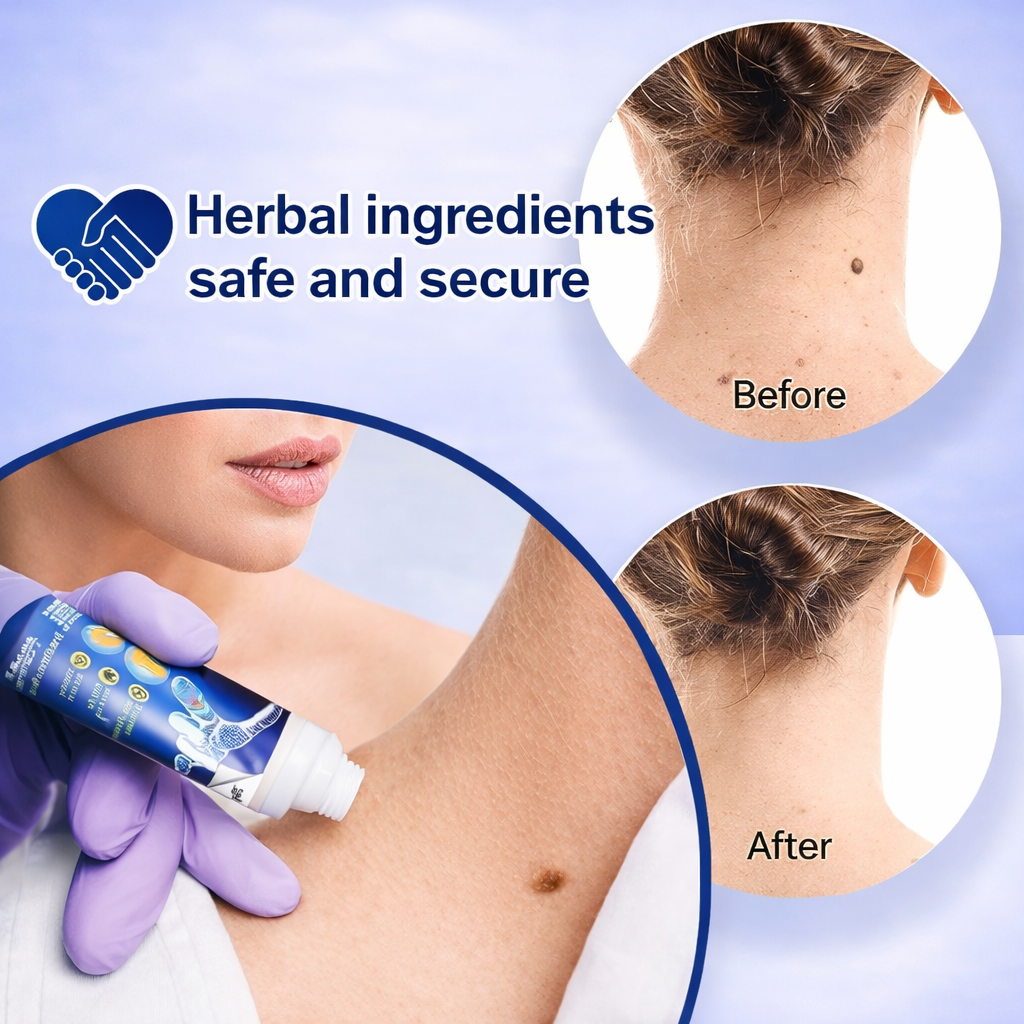 wartaway herbal cream